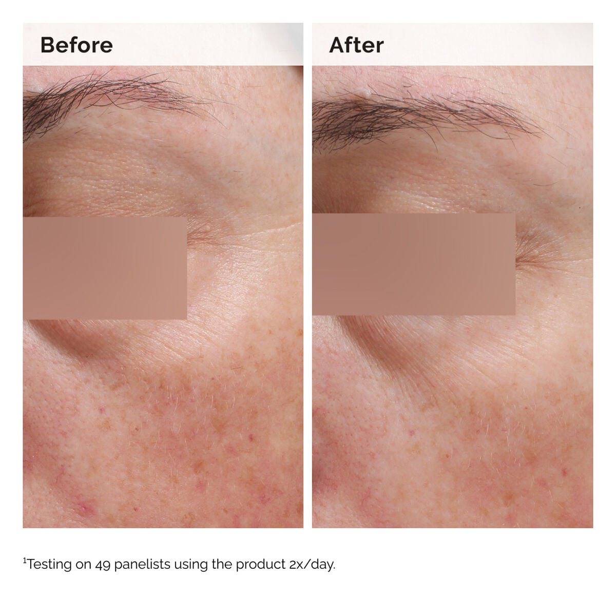 niacinamide-5-face-and-body-emulsion-p3 2024-08-23-ORD-Nia-5pct-Face-Body-B-A-Elasticity-Global-02-1x1.jpg