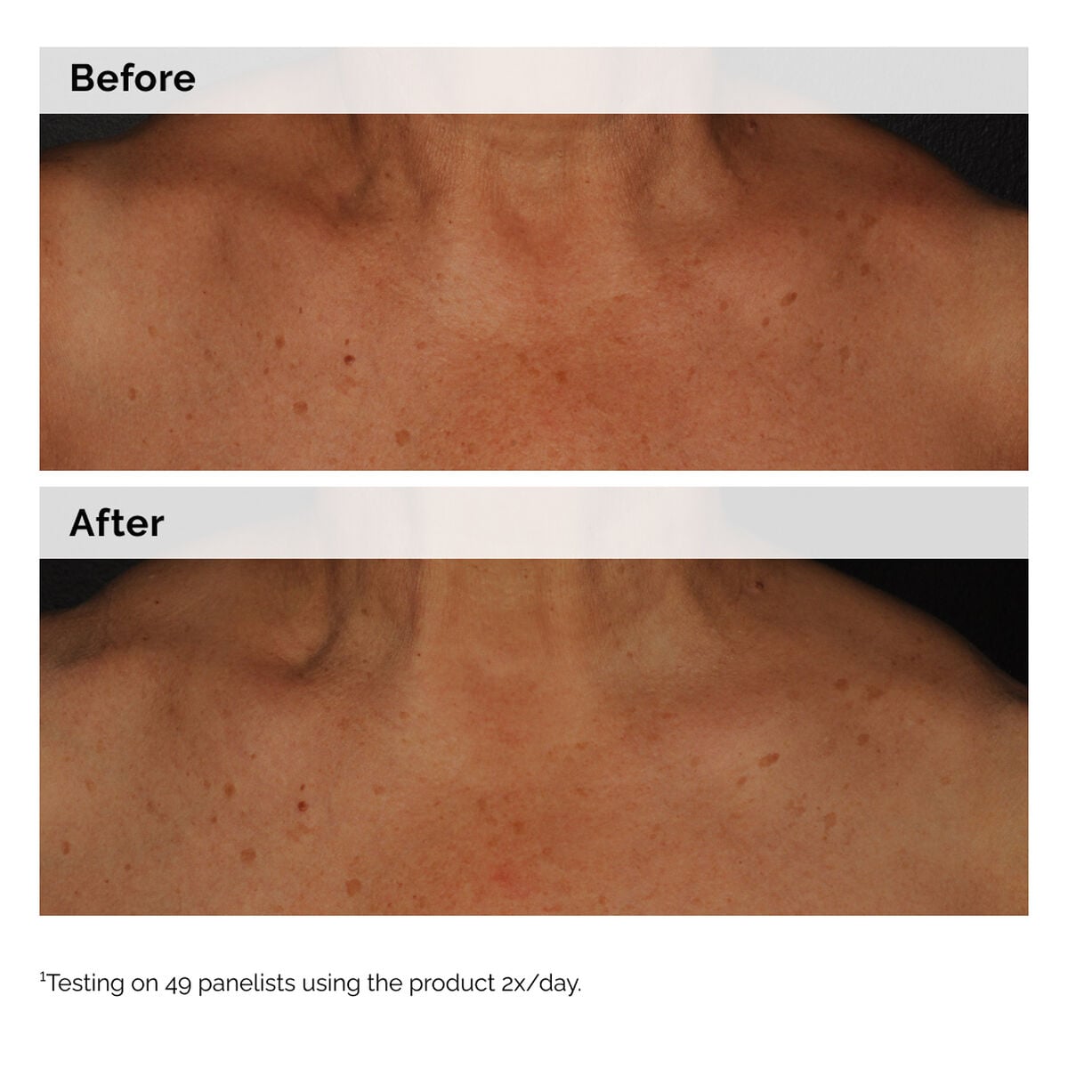 niacinamide-5-face-and-body-emulsion-p3 2024-08-23-ORD-Nia-5pct-Face-Body-B-A-Global-02-1x1.jpg