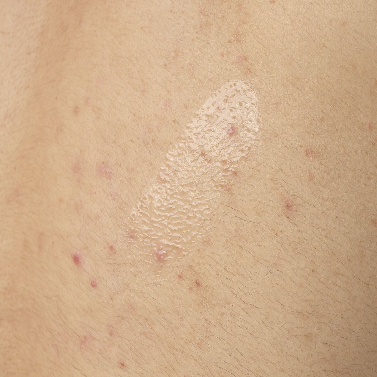salicylic-acid-0-5-body-serum-h3 ORD-salicylic-acid-05-body-240ml-application.jpg