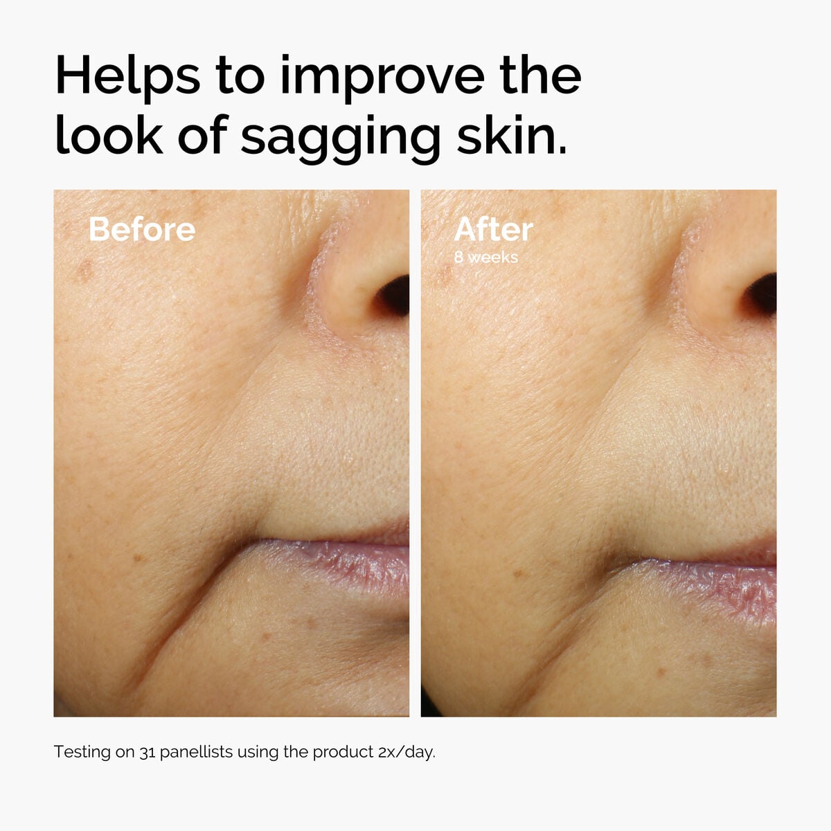 caffeine-3-escin-1-face-serum-m7 ord-caffeine-3pct-escin-1pct-face-serum-before-after-sagging.jpg