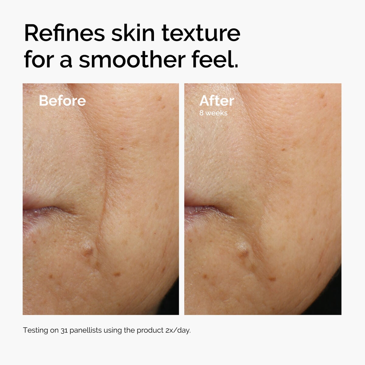 caffeine-3-escin-1-face-serum-m7 ord-caffeine-3pct-escin-1pct-face-serum-before-after-texture.jpg