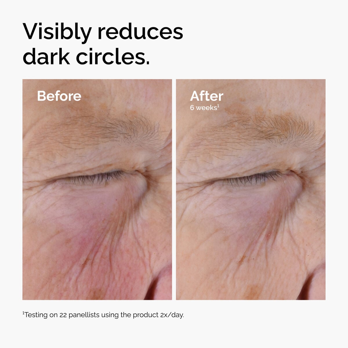 caffeine-solution-5-egcg-eye-serum-g3 ord-caffeine-solution-egcg-dark-circles-before-after.jpg