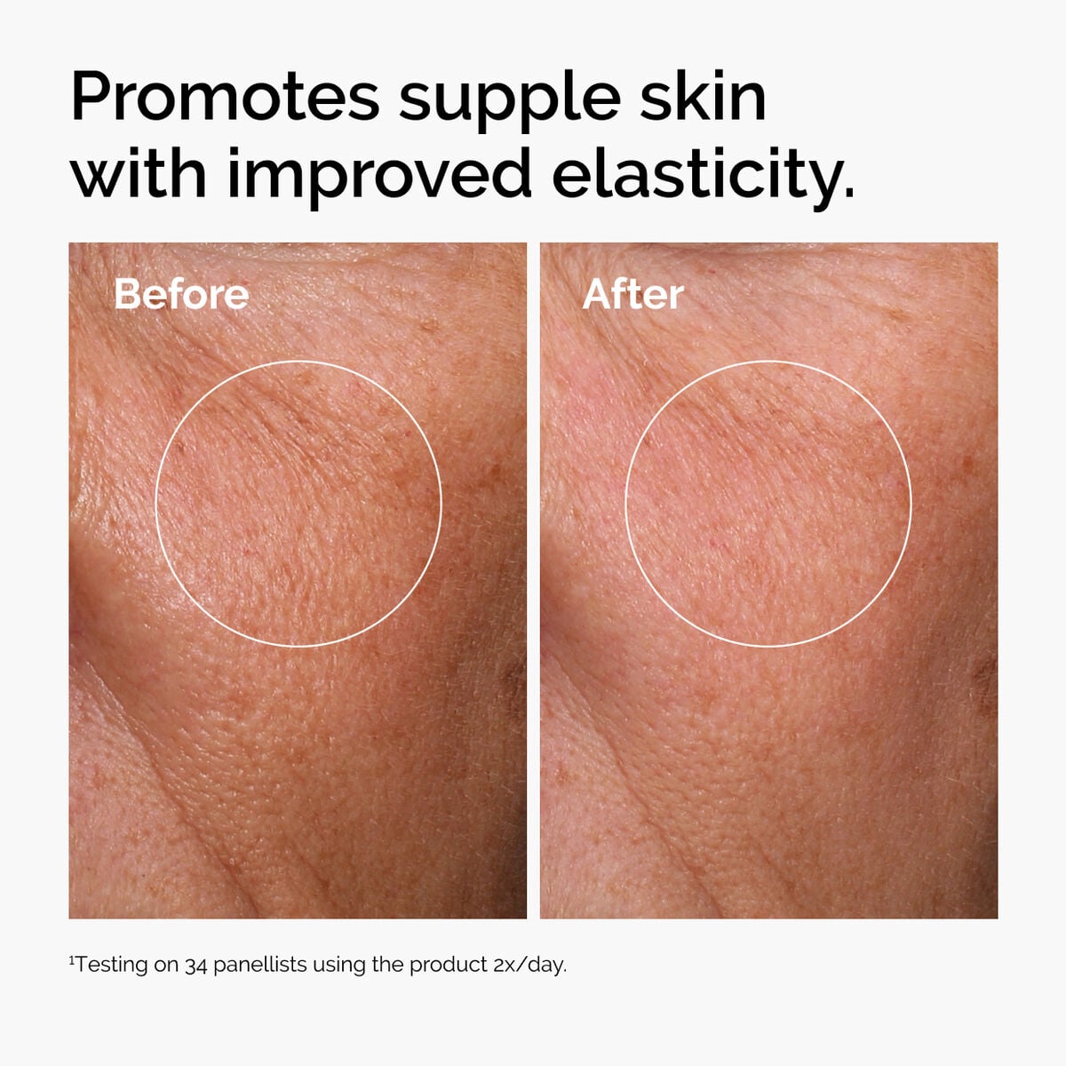 hyaluronic-acid-2-b5-with-ceramides-u2 ord-hyaluronic-acid-2pct-b5-hydrating-serum-before-after-elasticity.jpg