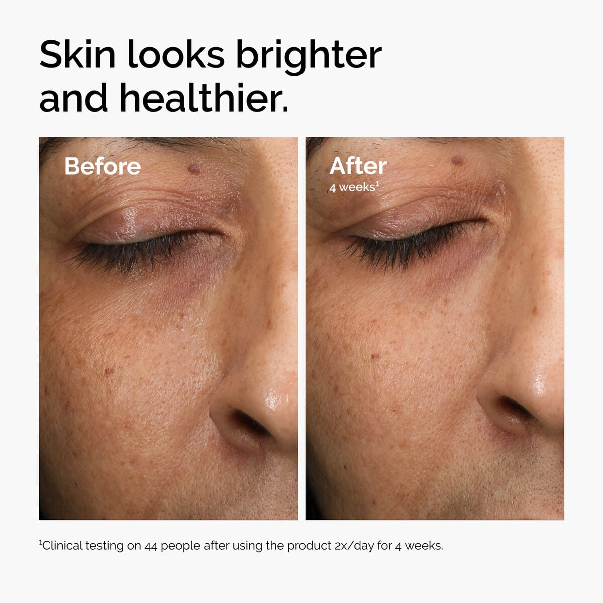 multi-antioxidant-radiance-serum-l9 ord-mars-before-after-healthy.jpg