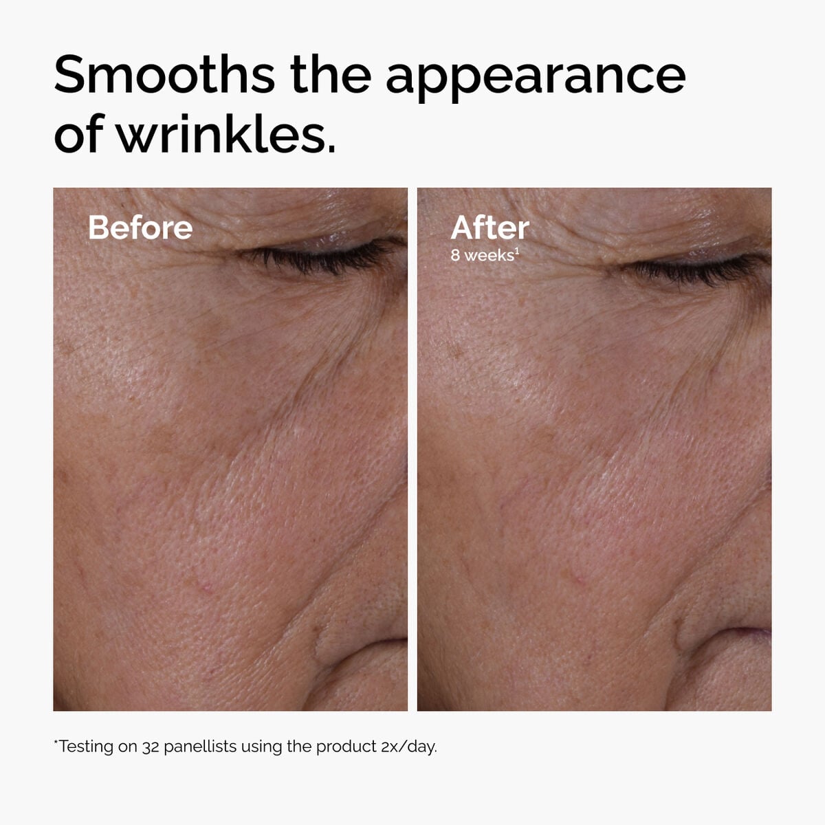 multi-peptide-ha-serum-e1 ord-multi-peptide-ha-serum-wrinkles-before-after.jpg