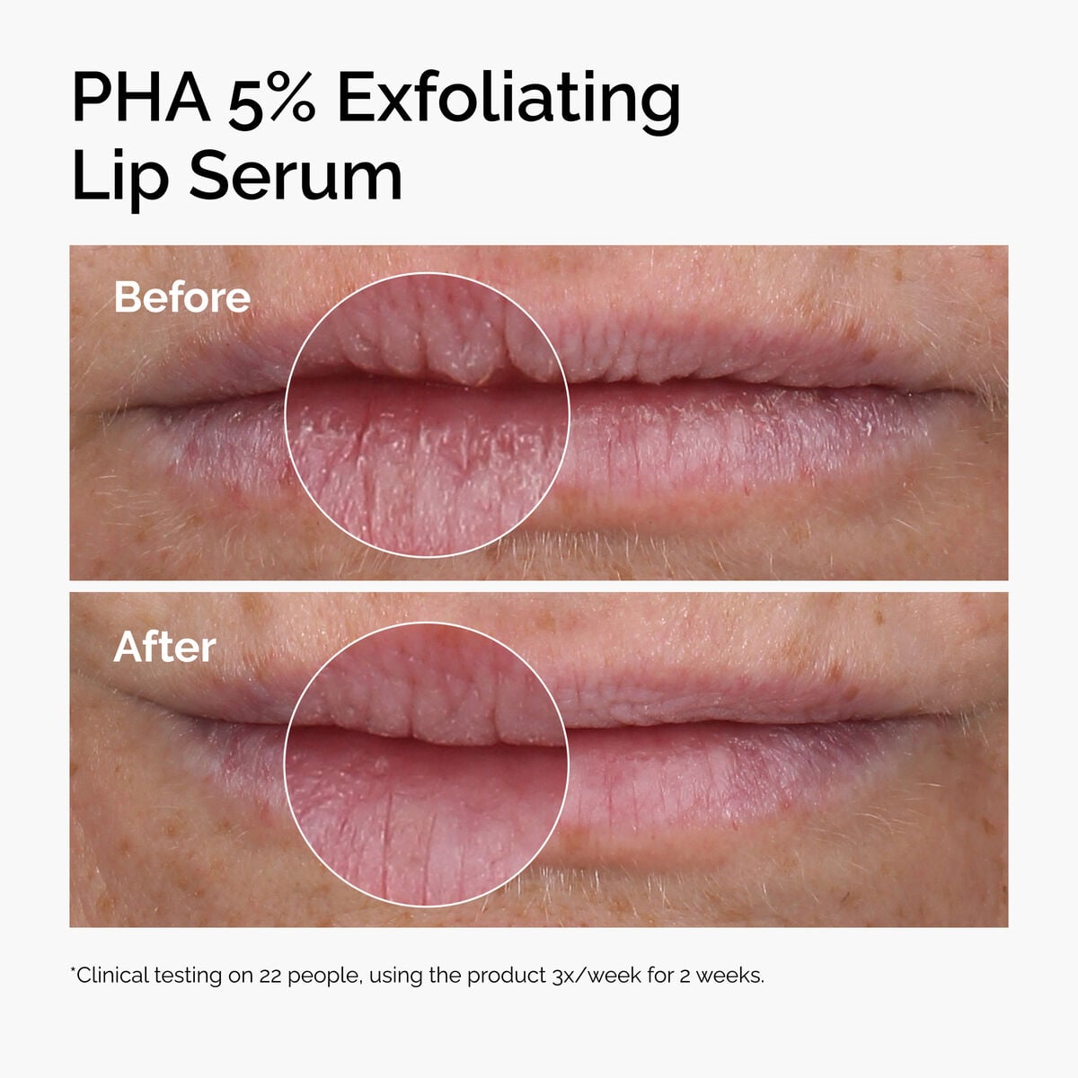 pha-5-exfoliating-lip-serum-g7 ord-pha-5pct-lip-exfoliating-serum-before-after.jpg