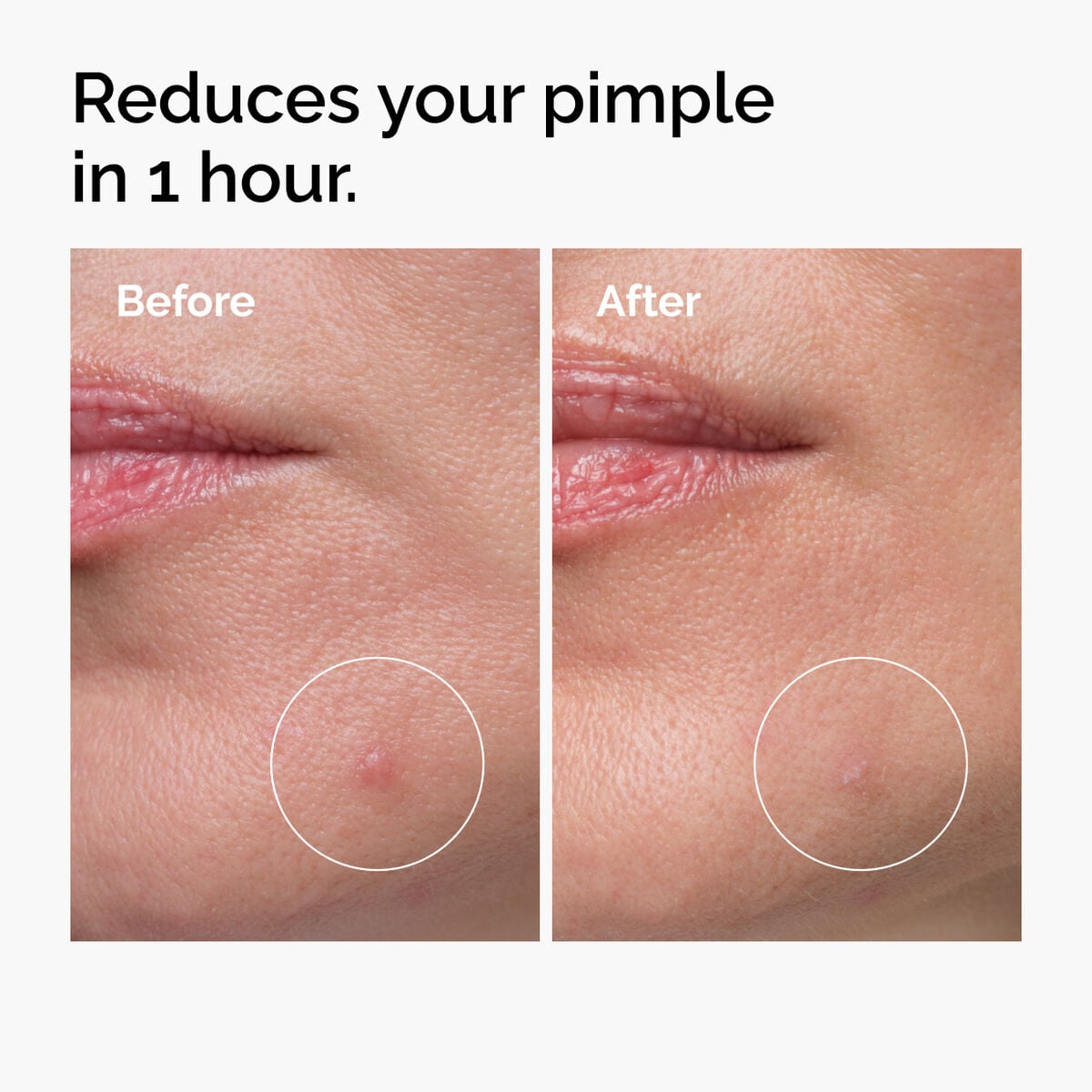 sulfur-10-powder-to-cream-concentrate-y2 ord-sulfur-10pct-powder-to-cream-concentrate-before-after-NA.jpg